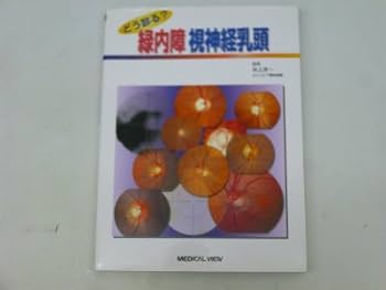 どう診る?緑内障視神経乳頭 緑内障／視神経乳頭陥凹拡大 | たける眼科 | 福岡市早良区 高取